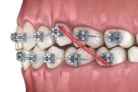 Orthodontics