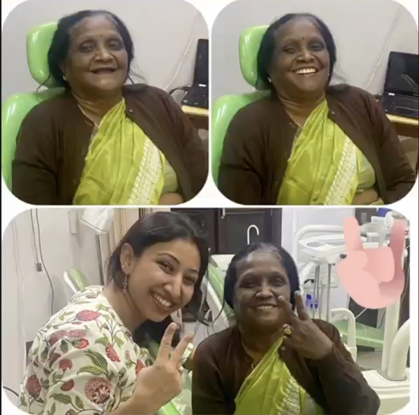 Smile Makeover Journey